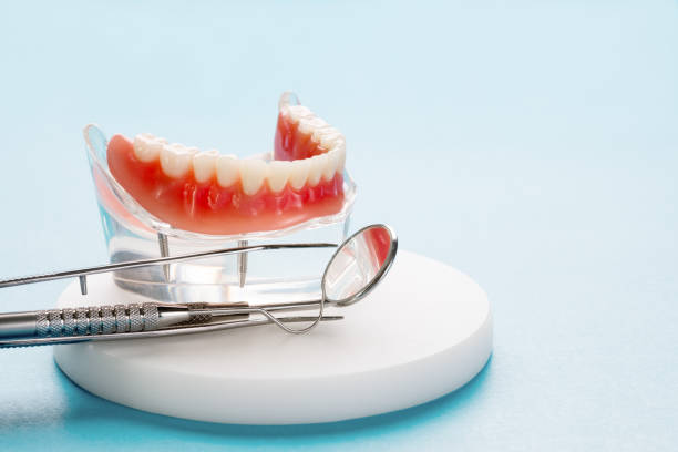 Dental Inlays and Onlays in Choudrant, LA
